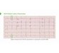 آموزش تفسیر ﻿Electrocardiogram (ECG) در تشخیص و درمان بیماریهای قلب 1