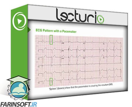 آموزش تفسیر ﻿Electrocardiogram (ECG) در تشخیص و درمان بیماریهای قلب